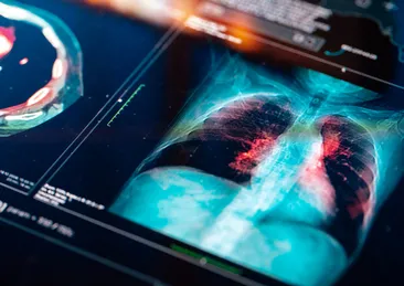 Elektronik sigara kullanımındaki korkunç tablo! Uzmanı uyardı: 5 yaşındaki çocuğun elinde gördüm