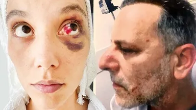 Ozan Güven'in şoförü tanık olarak ifade verdi! Ozan Güven'in özel şoförü o geceyi anlattı "Deniz Hanım Ozan yaralı ben bir şey yapmadım dedi" - Son Dakika Magazin Haberleri