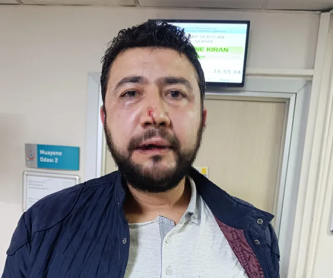 Keçiören Belediyesi'nde öldüresiye dayak skandalı!