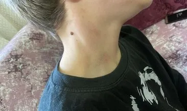 Bolu'da öğretmenden öğrenciye şiddet iddiası! Kafasına, kaburgasına vurduktan sonra sıraya fırlattı #bolu