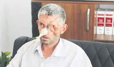 Gözünü kanserden kaybetmiş