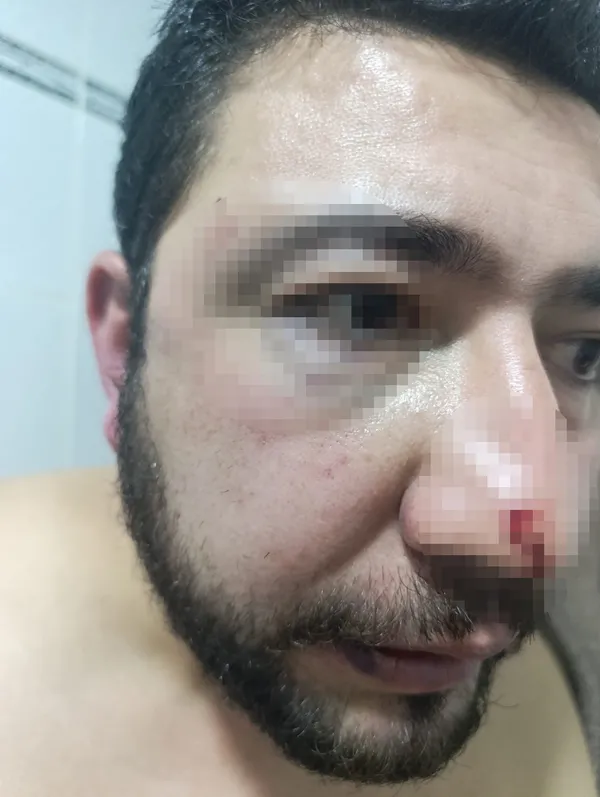 Keçiören Belediyesi'nde öldüresiye dayak skandalı!