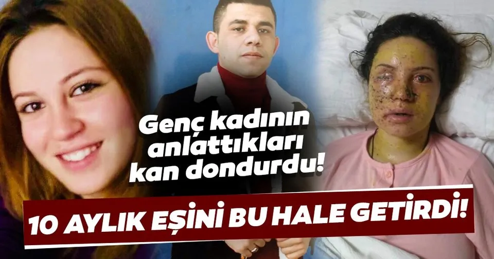 Dilek Y 10 aylık kocası vurdu ile ilgili görsel sonucu