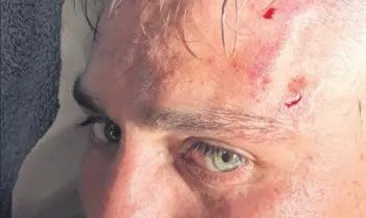 Forma rekabeti kan akıttı!