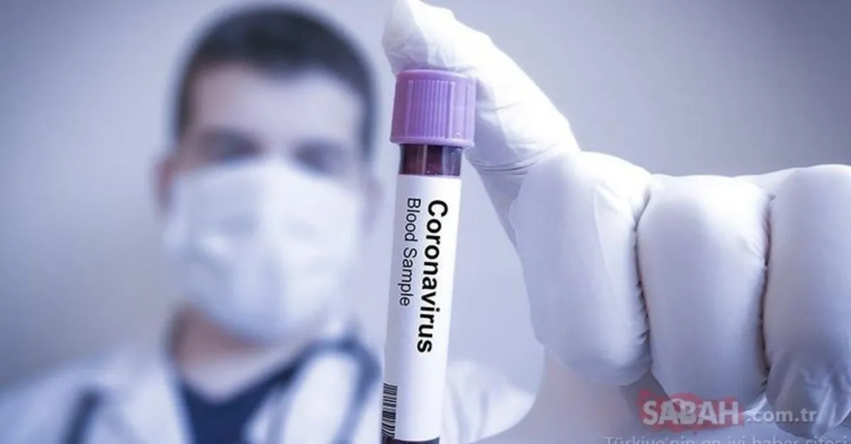 covid 19 test sonucu kac gunde cikar nasil ogrenilir e nabiz giris ile koronavirus test sonucu sorgulama ekrani son dakika yasam haberleri