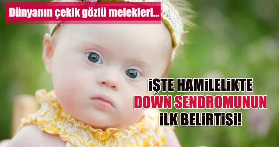 gebelikte down sendromunun belirtileri