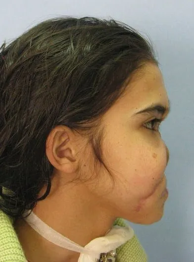 Hatice Nergis yeni yüzünü ilk kez gördü
