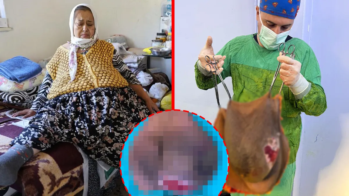 Gün geçtikçe büyüdü! Doktorlar bile gözlerine inanamadı: Karnından tam 40 kilo çıktı!