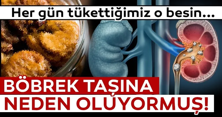 Her gün tükettiğimiz o besinin böbrek taşına neden olduğu ortaya çıktı