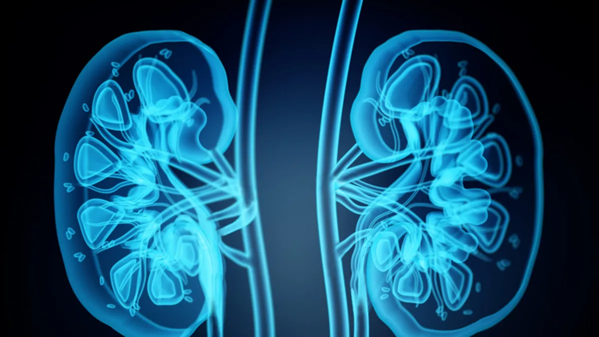 Taş hastalığı böbrek kaybına neden oluyor! Taş hastalığı böbrek kaybına neden oluyor!