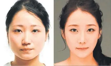 Hollywood yanaklı olmak çok kolay