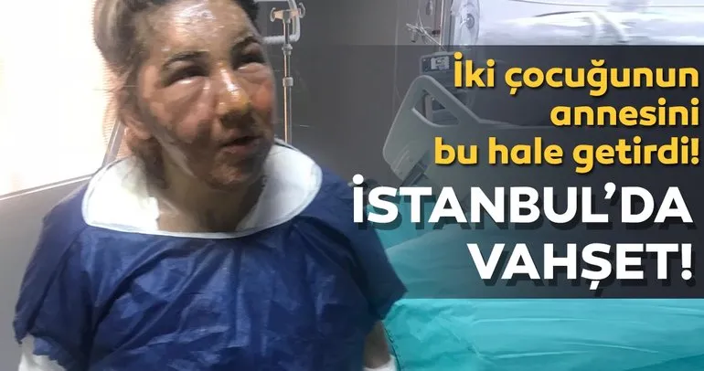 İstanbul’da vahşet: Cezaevinden izinli çıktı, eski eşini kızgın yağ ile yaktı