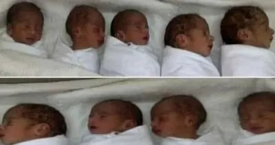 Dünya onları konuşuyor! Doğdukları an tarihe geçtiler: Tam manasıyla dokuz doğurdu...