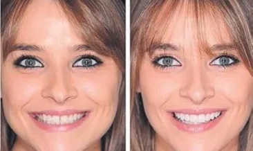 Covid-19 döneminde implant yapılabilir