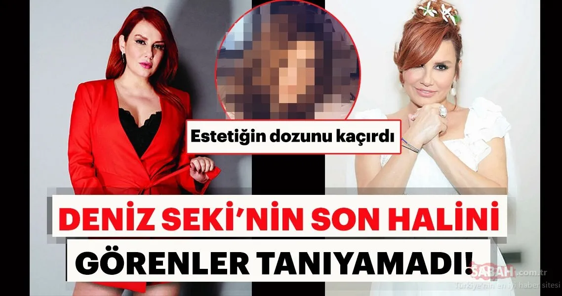 Deniz Sekinin Son Hali / Deniz Seki 18 kilo verdi son hali! Estetikle