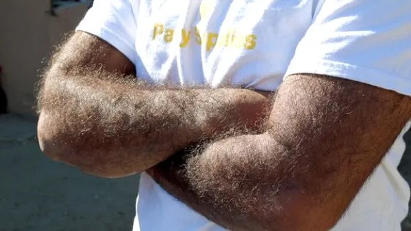 Tüm aile bu halde!