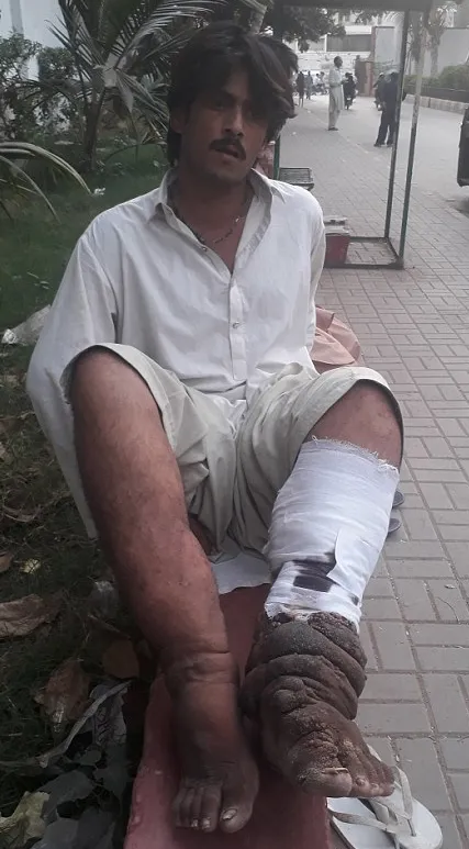 Bir sabah uyandığında bacağını böyle buldu!