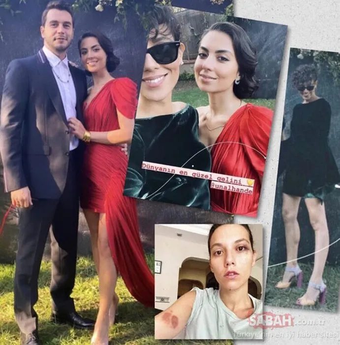 Deniz Bulutsuz�un son hali görenleri şaşkına çevirdi! İmaj yenileyen
