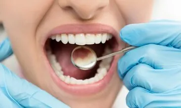 Dikkat çeken araştırma: Diş çürükleri durdurulabilir!