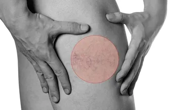 Varis oluşumunda bu 6 nedene dikkat!