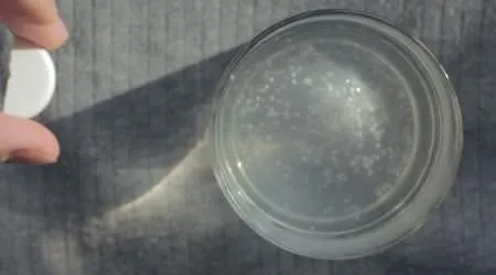 Meger Dogru Degilmis Alzheimer Bile Yapiyor Sayfa 4 Saglik Haberleri