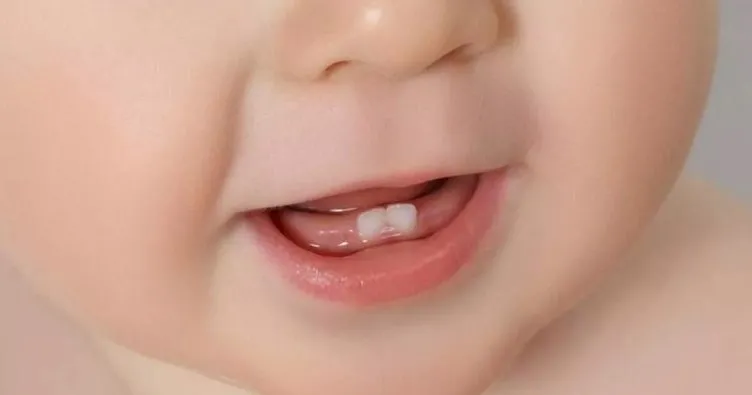 Rüyada Kendi Bebeğinin Dişinin Çıktığını Görmek Ne Anlama Gelir? Rüyada Bebeğinin Dişinin Çıkmasının Anlamı