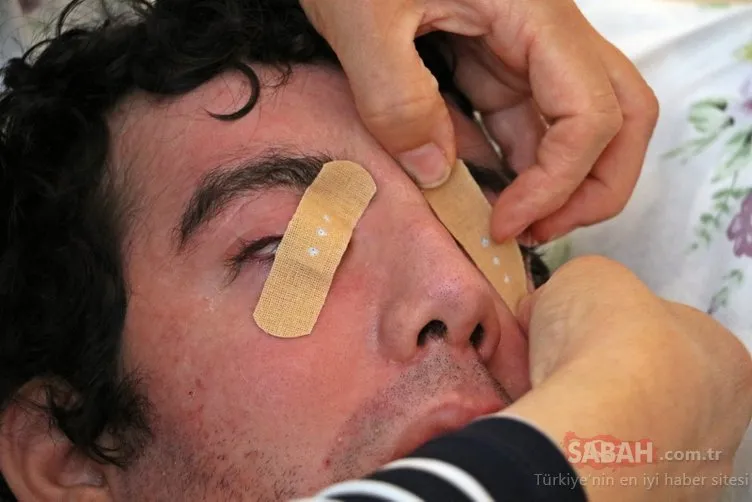 Son Dakika Haberi: Göz kapaklarını kırpamıyor! SSPE hastası olan Halil Özelik gözlerini yara bandı ile bile kapatamadı