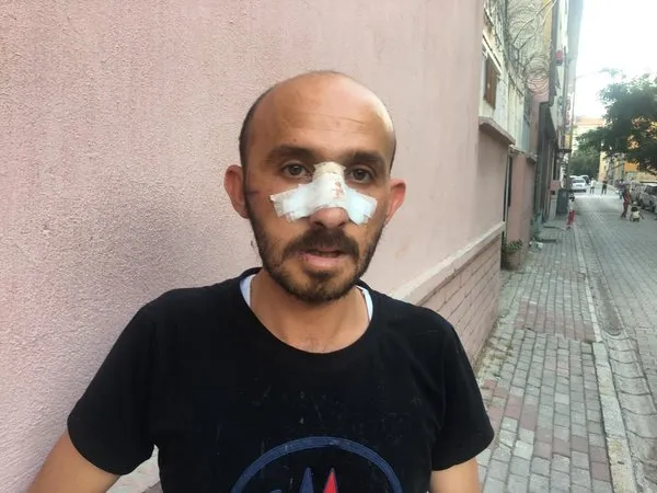 umit-ozdag-provokasyon-yapti-kendi-kazdi-kuyuya-dustu-1659771717894.jpg