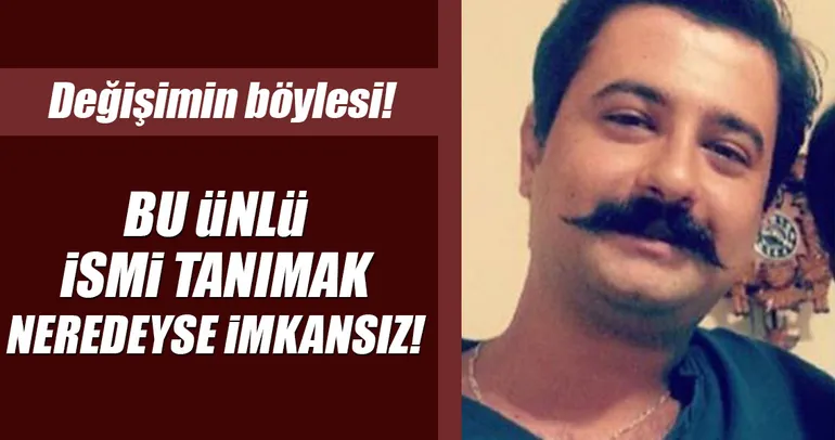 Koray Avcı Eski Hali