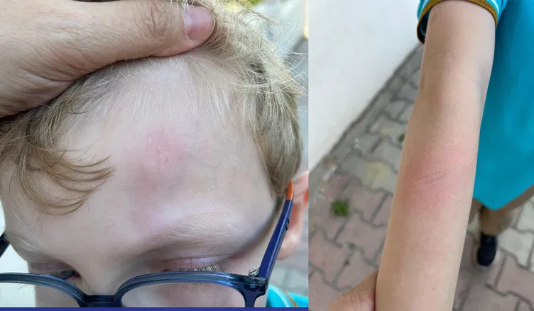 SON DAKİKA... İstanbul’da 7 yaşındaki çocuğa demir çubuklu dayak: Oğlun çok ağlıyor okula gel!