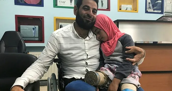 Suriyeli Maya Protez Tedavisi Icin Istanbul Da Sayfa 6 Dunya Haberleri