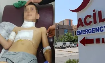 Dehşetin adresi bu kez Diyarbakır! Köpeğin saldırdığı 10 yaşındaki Ahmet ağır yaralandı! #diyarbakir