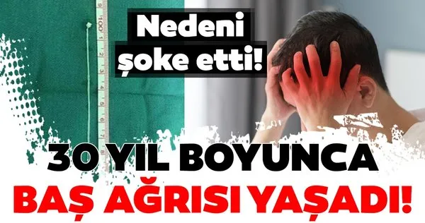 30 yıl boyunca baş ağrısı çekti! Nedeni ise...