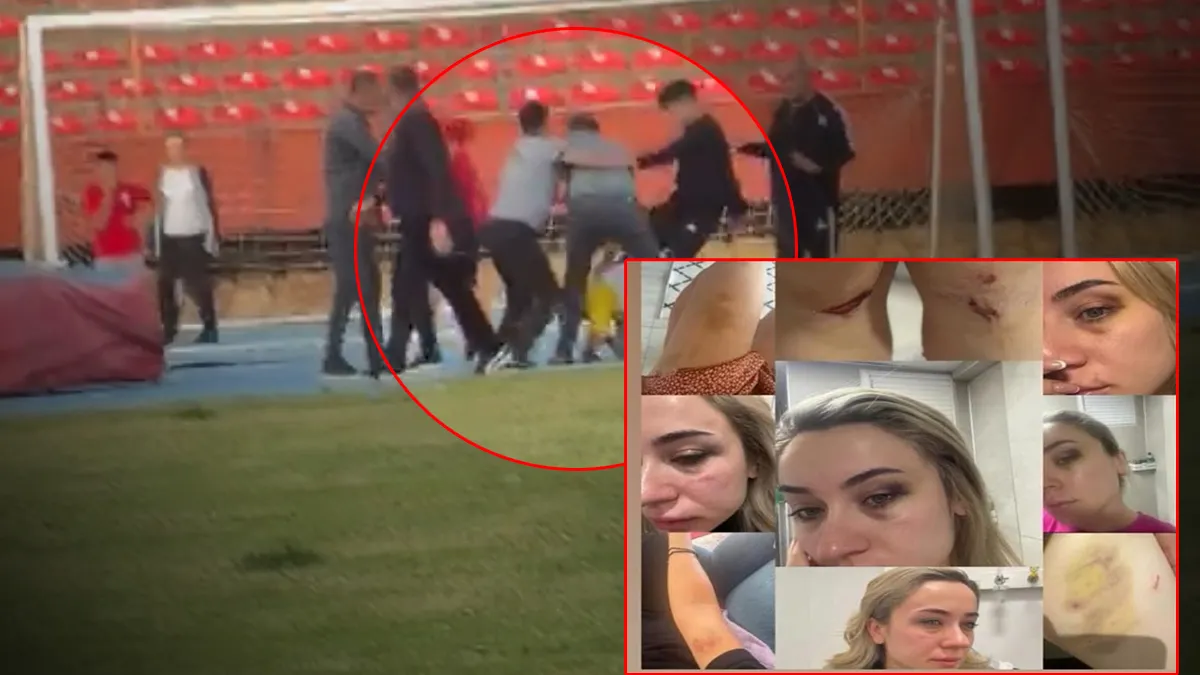 Zonguldak'ta eski eşe tekme-tokat dayak: Elif öğretmenin sosyal medya paylaşımları yürek burkmuştu! Abisi ve arkadaşları...