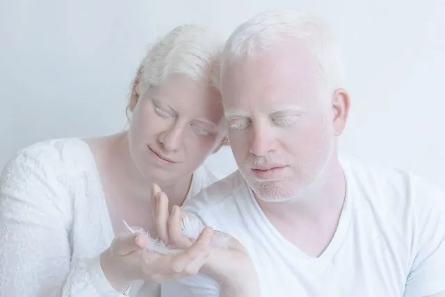 Albinoların eşsiz güzellikleri fotoğraflara yansıdı!