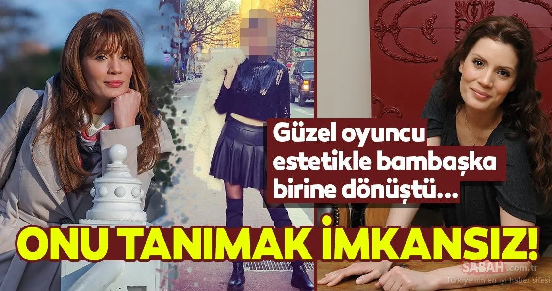 Ünlü oyuncu Ayça Varlıer estetikle bambaşka birine dönüştü! Ayça