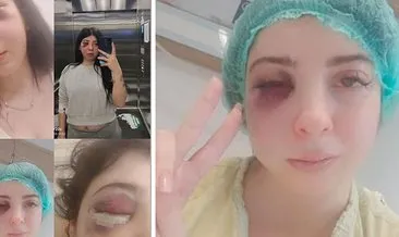 Samsun'da korkunç olay! Sokak ortasında tacize uğradı, darp edildi: Uyuyamıyor, yemek yiyemiyorum #samsun