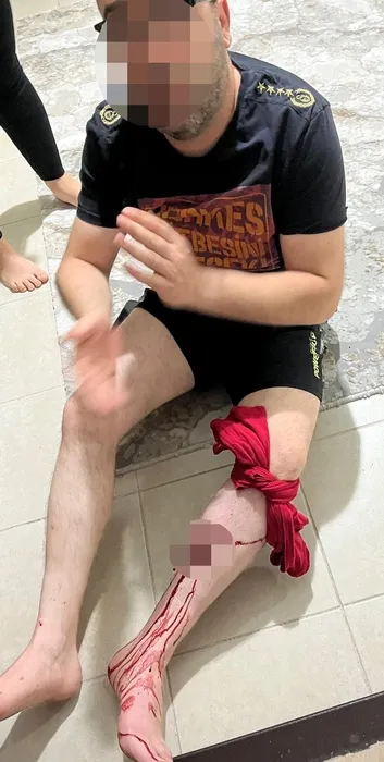 Konya’da akılalmaz olay: Kardeşi milyonlar ile kaçtı: Kabak abisinin başında patladı!