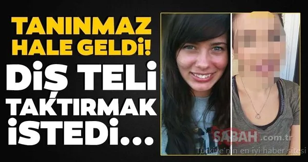 İnanılmaz ama gerçek! Diş teli taktırınca...