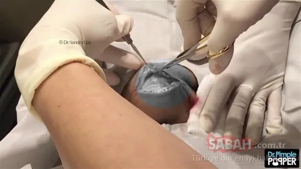 Doktora bu halde geldi! Sonrasındaysa...