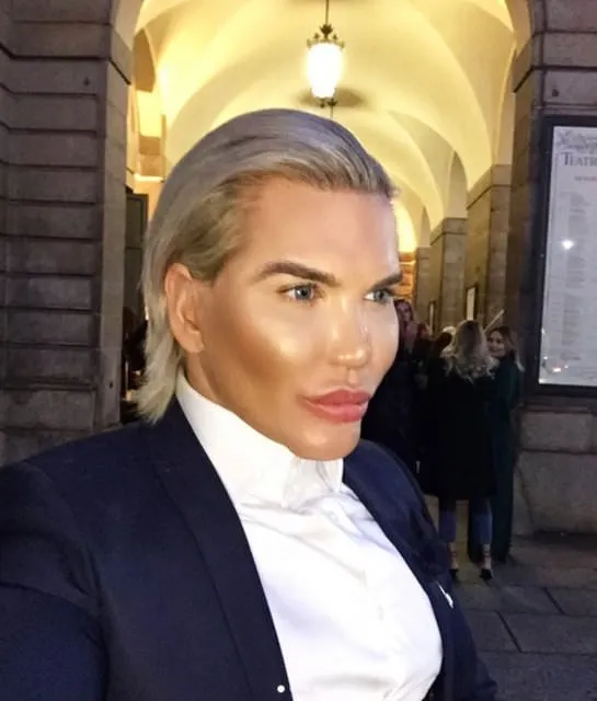 İşte Ken Bebek Rodrigo Alves'in estetiksiz hali