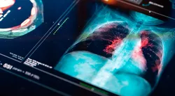 Elektronik sigara kullanımındaki korkunç tablo! Uzmanı uyardı: 5 yaşındaki çocuğun elinde gördüm