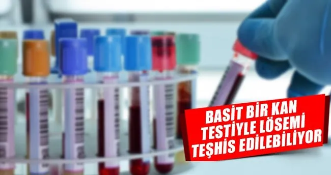 Basit bir kan testiyle lösemi teşhis edilir