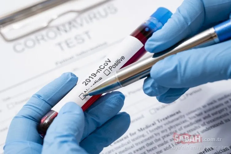 E Nabız ile koronavirüs test sonucu sorgulama! Corona virüs test sonuçları nasıl öğrenilir?
