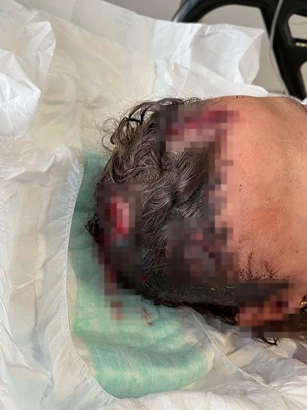Ukrayna asıllı Türk vatandaşı Iryna’ya kocası öyle şeyler yaptı ki: Beni öldürmeye geldi!