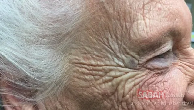 20 yıl bu şekilde yaşadı....Kafasından çıkanlar şoke etti!