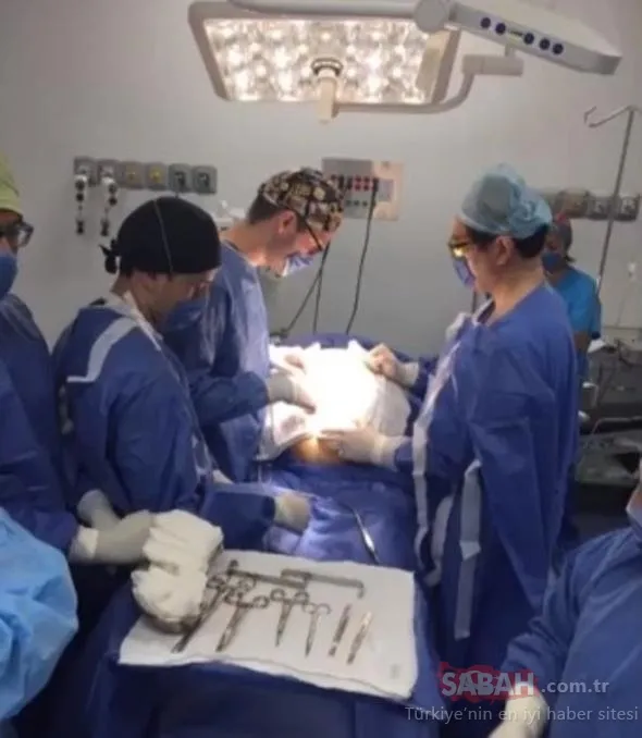 Doktorlar bile şok oldu! Bebeğini görmek için hastaneye gitti, karnından tam 26 kilo ağırlığında…