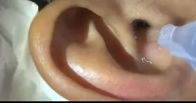 Kulağındaki rahatsız edici sesten şikayet ediyordu! Nedenini öğrenince şoka uğradı