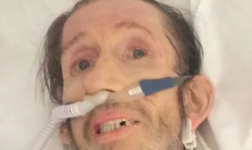 Son haliyle yürekleri burkuyor! Ünlü yıldızın eşinden açıklama: Kaybetmekten korkuyorum