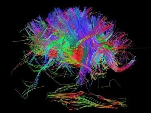 İnsan beyninin en detaylı görüntüleri